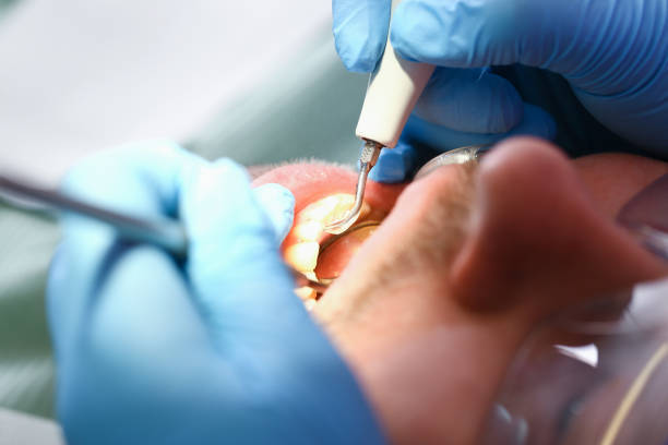 Best Emergency Treatment for Dental Infections or Abscesses in Park Hills, KY