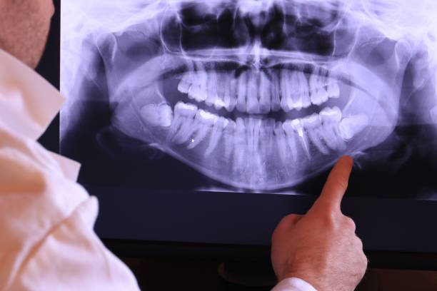 Best Emergency Dental Care for Broken or Chipped Teeth in Park Hills, KY
