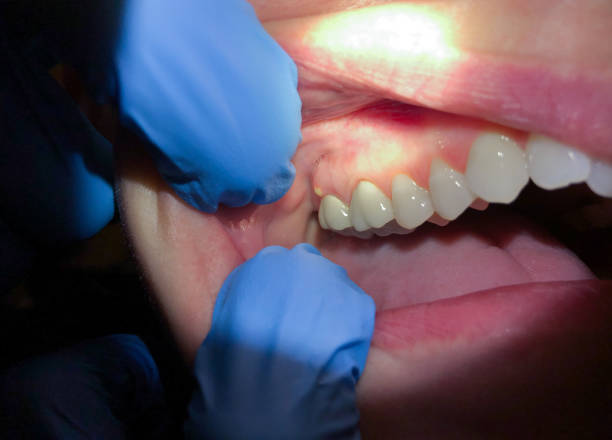 Best Emergency TMJ Treatment in Park Hills, KY